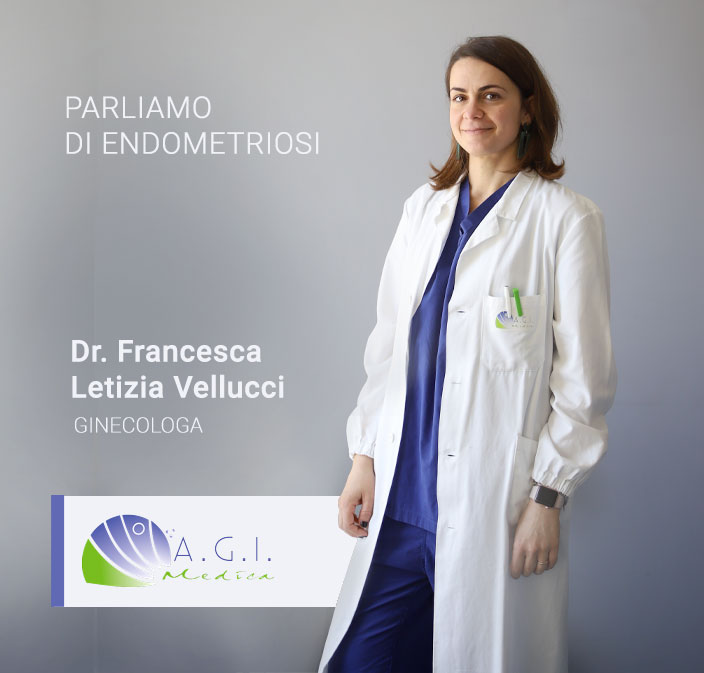 ENDOMETRIOSI